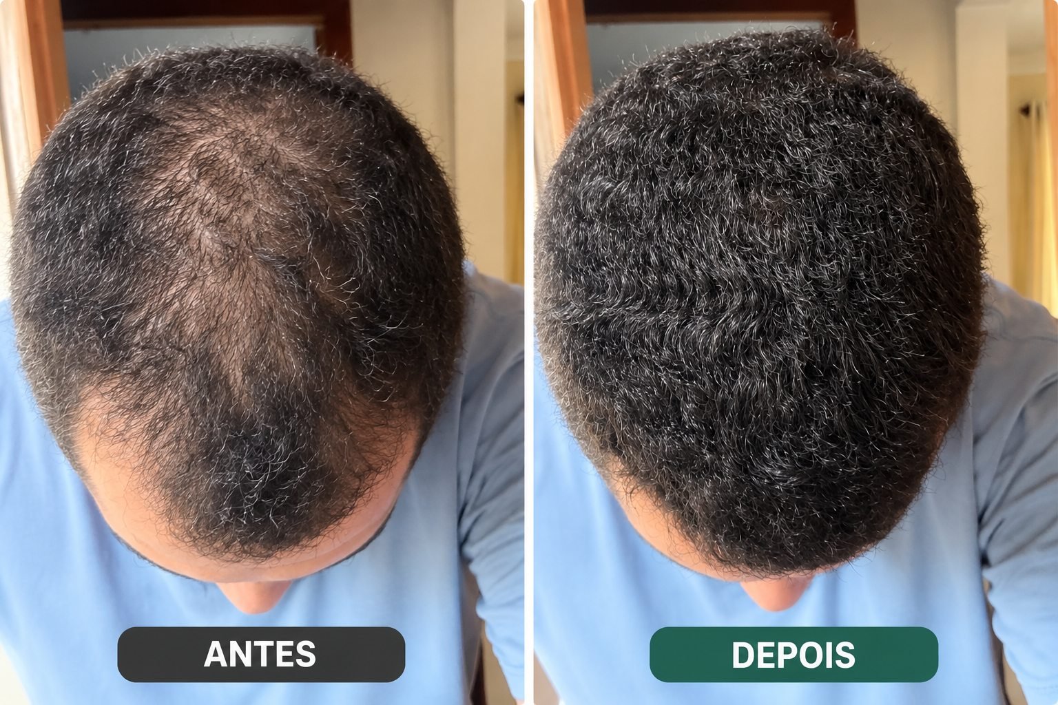 Comparação capilar: antes, à esquerda, com falhas visíveis; depois, à direita, com aparência mais preenchida.